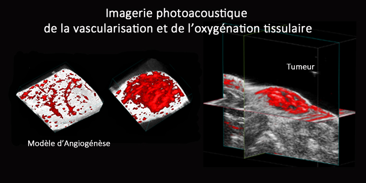 Illustration d'imagerie photoacoustique de la vascularisation et de l'oxygénation tissulaire