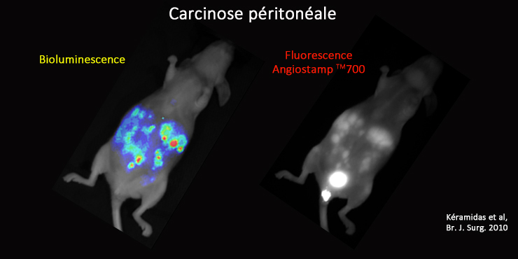 Illustration de bioluminescence et fluorescence de carcinose péritonéale